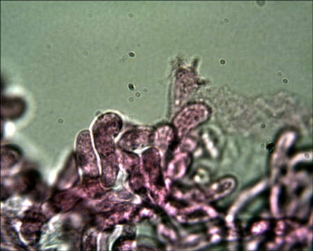 Trechispora mollusca ? (Trechispora mollusca)